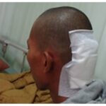 Ape Pasien Keluarga Miskin Subang