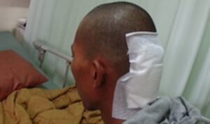 Ape Pasien Keluarga Miskin Subang