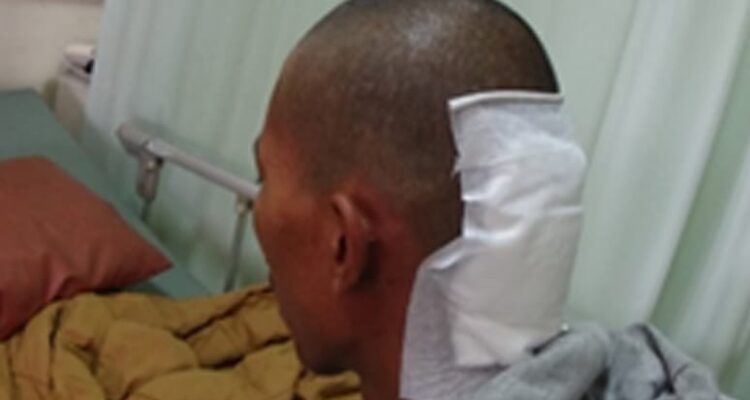 Ape Pasien Keluarga Miskin Subang