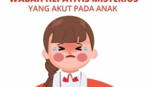 Antisipasi Hepatitis Akut, Inilah yang Dilakukan Dinkes Kota Cimahi Antisipasi Hepatitis Akut, Inilah yang Dilakukan Dinkes Kota Cimahi