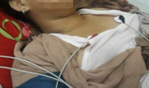 Korban Pemerkosaan Masih Dirawat, Polres Subang Baru Ringkus Tiga Pelaku