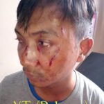 Penganiayaan Berat Jadi Ringan, Proses Hukum Kasus YT Janggal?