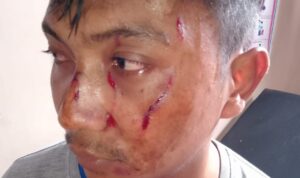 Penganiayaan Berat Jadi Ringan, Proses Hukum Kasus YT Janggal?