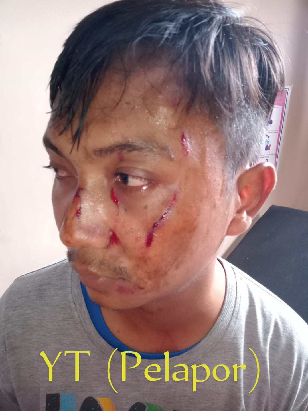 Penganiayaan Berat Jadi Ringan, Proses Hukum Kasus YT Janggal?