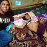 Butuh Perhatian Pemerintah, Dokmaru Indramayu Gercep Tangani Anak Yatim Penderita Lumpuh